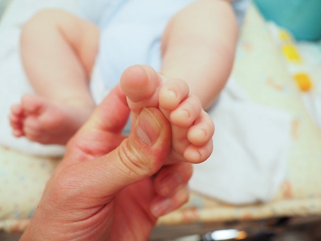 Левая нога косолапит 1 год ребенку