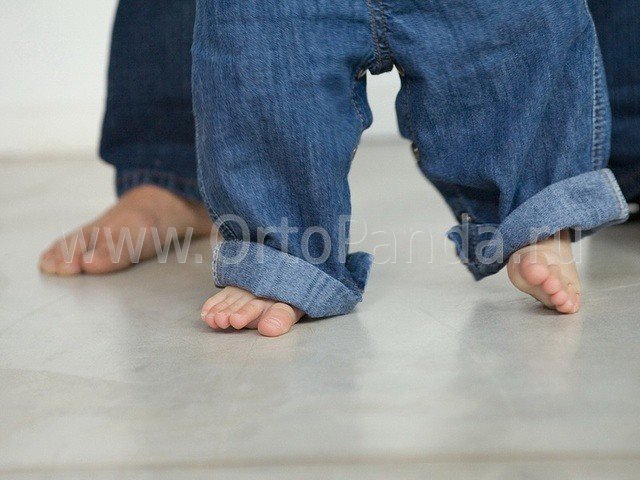 Ребенку 3 года косолапит левой ногой