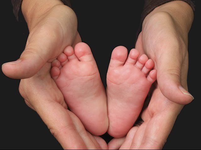 Как вылечить косолапие ножки новорожденного